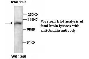 Image no. 1 for anti-Anillin, Actin Binding Protein (ANLN) antibody (ABIN1574694) (Anillin 抗体)