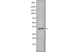 Western blot analysis OR52P1 using HeLa whole cell lysates (OR52P1 抗体)
