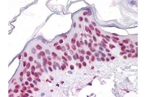 Immunohistochemistry (IHC) image for anti-Sirtuin 1 (SIRT1) (AA 456-555) antibody (ABIN614713) (SIRT1 抗体  (AA 456-555))