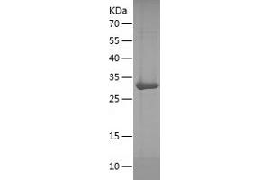 Western Blotting (WB) image for Transducin-Like Enhancer of Split 1 (E(sp1) Homolog, Drosophila) (TLE1) (AA 1-251) protein (His tag) (ABIN7125453) (TLE1 Protein (AA 1-251) (His tag))