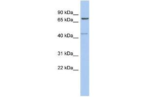 WB Suggested Anti-PEX5 Antibody Titration: 0. (PEX5 抗体  (Middle Region))