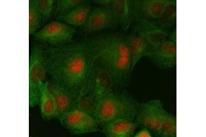 IF analysis of FAF1 using anti-FAF1 antibody (ABIN7602657) and anti-Beta Tubulin antibody (ABIN7602743). (FAF1 抗体  (AA 91-650))