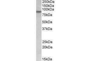 AP23219PU-N FSD1 antibody staining of HeLa lysate at 0. (RUFY1 抗体  (Internal Region))