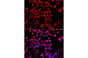 Immunofluorescence analysis of A549 cells using CFL2 antibody (ABIN5974961). (Cofilin 2 抗体)