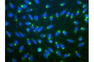 Immunofluorescent staining of aggresomes of mouse L-cells treated with lactacysteine, using RPS27A polyclonal antibody . (RPS27A 抗体)