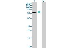 Western Blot analysis of CBS expression in transfected 293T cell line by CBS MaxPab polyclonal antibody. (CBS 抗体  (AA 1-551))