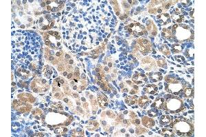 SLC22A7 antibody was used for immunohistochemistry at a concentration of 4-8 ug/ml to stain Epithelial cells of renal tubule (arrows) in Human Kidney. (SLC22A7 抗体)