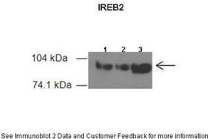 Western Blotting (WB) image for anti-Iron-Responsive Element Binding Protein 2 (IREB2) (Middle Region) antibody (ABIN2778884) (IREB2 抗体  (Middle Region))