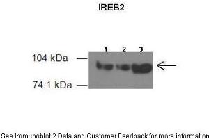 Western Blotting (WB) image for anti-Iron-Responsive Element Binding Protein 2 (IREB2) (Middle Region) antibody (ABIN2778884)