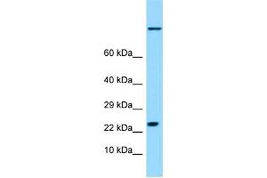 WB Suggested Anti-HSPB9 Antibody Titration: 1. (HSPB9 抗体  (Middle Region))