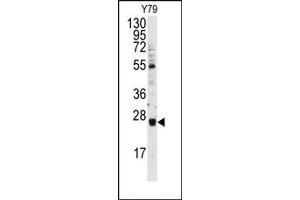 Image no. 1 for anti-Ubiquitin-Conjugating Enzyme E2E 3 (UBE2E3) (N-Term) antibody (ABIN357598) (UBE2E3 抗体  (N-Term))