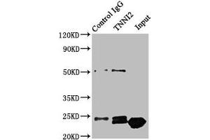 Western Blotting (WB) image for anti-Fast Skeletal Troponin I (TNNI2) (AA 1-100) antibody (ABIN7173581)