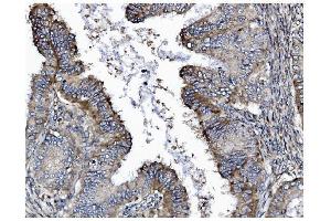 IHC analysis of GSDMD using anti-GSDMD antibody (ABIN7599433).