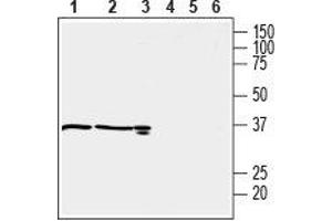 Western blot analysis of mouse kidney (lanes 1 and 4), rat kidney (lanes 2 and 5) (1:600) and rat testis (lanes 3 and 6) (1:200) lysates: - 1-3. (OXGR1 抗体  (C-Term, Intracellular))