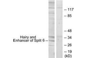 Western blot analysis of extracts from HeLa cells, using HES6 Antibody. (HES6 抗体  (AA 1-50))