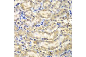 Immunohistochemistry of paraffin-embedded mouse kidney using MBP antibody (ABIN5970825) at dilution of 1/200 (40x lens). (MBP 抗体)
