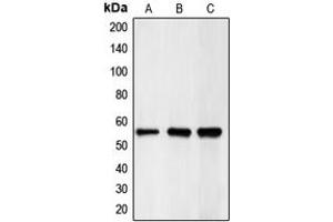 Western blot analysis of CHK1 expression in HeLa (A), mouse kidney (B), rat heart (C) whole cell lysates. (CHEK1 抗体  (Center))