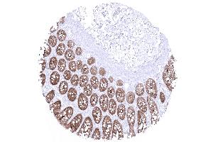 colon descendens mucosa (Recombinant Villin 1 抗体  (AA 600-700))