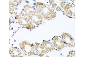 Immunohistochemistry (Paraffin-embedded Sections) (IHC (p)) image for anti-Coenzyme Q Biosynthesis Protein 7 (Coq7) antibody (ABIN7263793)