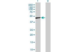 Western Blot analysis of WBSCR16 expression in transfected 293T cell line by WBSCR16 MaxPab polyclonal antibody. (WBSCR16 抗体  (AA 1-464))