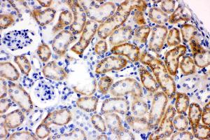 AK2 was detected in paraffin-embedded sections of mouse kidney tissues using rabbit anti- AK2 Antigen Affinity purified polyclonal antibody (Catalog # ) at 1 µg/mL. (Adenylate Kinase 2 抗体  (AA 161-239))