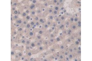 IHC-P analysis of Rat Tissue, with DAB staining. (Vitamin D-Binding Protein 抗体  (AA 395-475))
