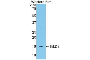 Western blot analysis of the recombinant protein. (HPSE 抗体  (AA 419-535))