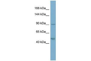 Western Blotting (WB) image for anti-Plakophilin 2 (PKP2) (N-Term) antibody (ABIN2786784)