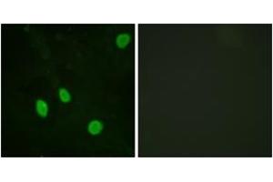 Immunofluorescence analysis of HeLa cells, using Cyclin H (Ab-315) Antibody. (Cyclin H 抗体  (AA 274-323))