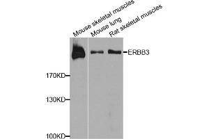 Western blot analysis of extracts of various cell lines, using ERBB3 antibody. (ERBB3 抗体)