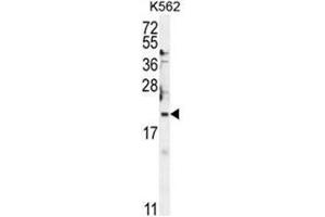 BTG2 Antibody (N-term) western blot analysis in K562 cell line lysates (35µg/lane). (BTG2 抗体  (N-Term))
