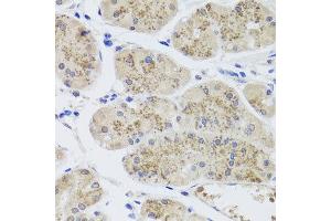 Immunohistochemistry of paraffin-embedded human stomach using MTERFD3 antibody at dilution of 1:100 (x40 lens). (MTERFD3 抗体)