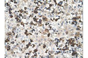 Image no. 1 for anti-Hemoglobin, zeta (HBZ) (AA 31-80) antibody (ABIN204990) (HBZ 抗体  (AA 31-80))