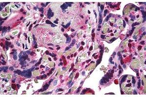 Human Placenta: Formalin-Fixed, Paraffin-Embedded (FFPE) (RBX1 抗体  (C-Term))