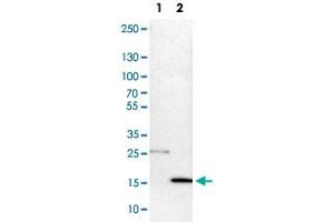 Western Blot analysis of Lane 1: NIH-3T3 cell lysate (mouse embryonic fibroblast cells) and Lane 2: NBT-II cell lysate (Wistar rat bladder tumor cells) with DNAL4 polyclonal antibody . (DNAL4 抗体)