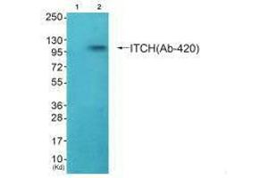 Western blot analysis of extracts from HepG2 cells (Lane 2), using ITCH (Ab-420) antiobdy. (ITCH 抗体  (Tyr420))