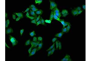 Immunofluorescence staining of HepG2 cells with ABIN7152156 at 1:133, counter-stained with DAPI. (EIF3G 抗体  (AA 2-320))