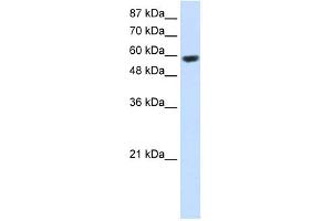 WB Suggested Anti-RNF14 Antibody Titration:  2. (RNF14 抗体  (C-Term))