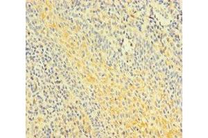 Immunohistochemistry of paraffin-embedded human tonsil tissue using ABIN7153002 at dilution of 1:100 (FNIP1 抗体  (AA 221-508))