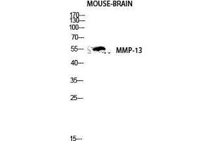 Western Blot (WB) analysis of Mouse Brain lysis using MMP-13 antibody.