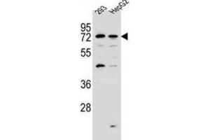 Western Blotting (WB) image for anti-GTPase, IMAP Family Member 8 (GIMAP8) antibody (ABIN2997226) (GIMAP8 抗体)