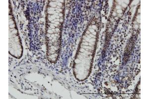 Immunostaining (ISt) image for anti-Signal Transducer and Activator of Transcription 6, Interleukin-4 Induced (STAT6) (AA 694-801) antibody (ABIN563038)