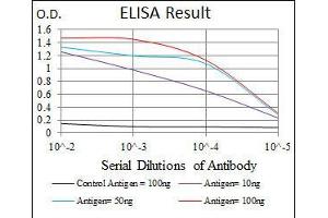 Black line: Control Antigen (100 ng), Purple line: Antigen(10 ng), Blue line: Antigen (50 ng), Red line: Antigen (100 ng), (LRP5 抗体)