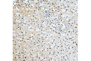 IHC analysis of LIGHT/TNFSF14 using anti-LIGHT/TNFSF14 antibody (ABIN7599138).