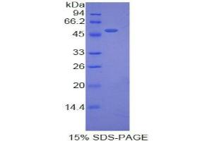 SDS-PAGE analysis of Pig Erythropoietin Protein. (EPO 蛋白)
