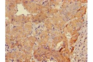 Immunohistochemistry (IHC) image for anti-gamma-aminobutyric Acid (GABA) A Receptor, beta 3 (GABRB3) (AA 328-450) antibody (ABIN7153497)