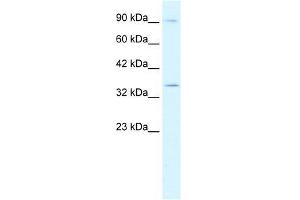 Human Jurkat; WB Suggested Anti-BHLHB5 Antibody Titration: 0.