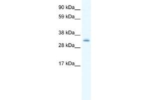 WB Suggested Anti-PDLIM1 Antibody Titration:  0. (PDLIM1 抗体  (Middle Region))