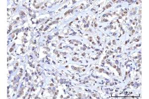 IHC analysis of RANBP2 using anti-RANBP2 antibody (ABIN7602650). (RANBP2 抗体  (AA 906-2744))