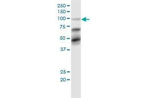 TRIM28 monoclonal antibody (M02), clone 1D11.